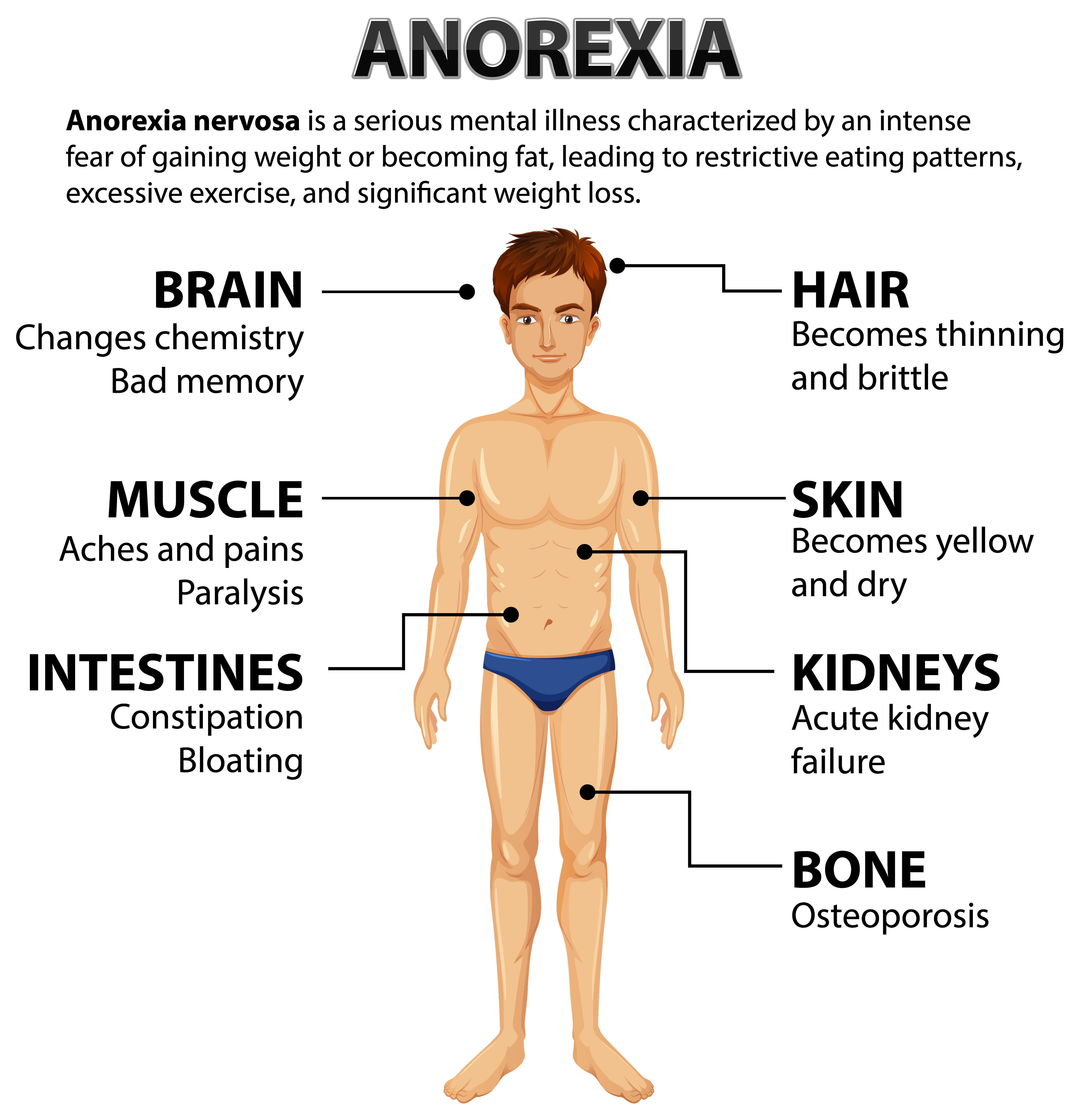 Body Type Diagram
